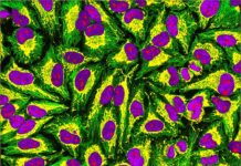 SLCC to celebrate Henrietta Lacks’ contribution to science on Dec. 5 HeLa cells showing microtubules (green), mitochondria (yellow), nucleoli (red) and nuclear DNA (purple)