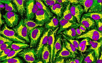 SLCC to celebrate Henrietta Lacks’ contribution to science on Dec. 5 HeLa cells showing microtubules (green), mitochondria (yellow), nucleoli (red) and nuclear DNA (purple)